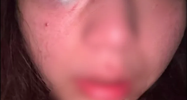 Penganiayaan Denpasar, perempuan muda, kekasih, Kesiman Kertalangu, Denpasar Timur, Polresta Denpasar, kasus penganiayaan, dugaan kekerasan.