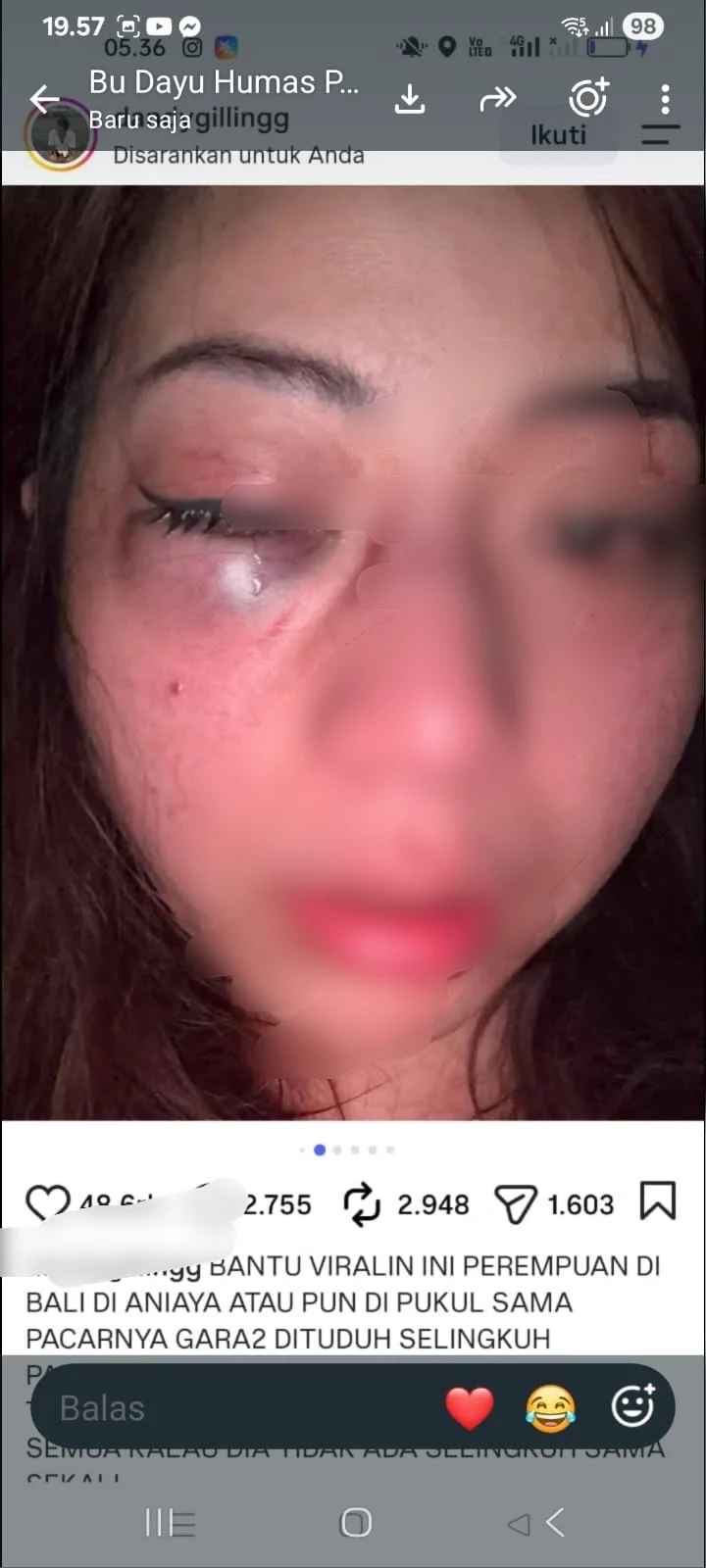 Penganiayaan Denpasar, perempuan muda, kekasih, Kesiman Kertalangu, Denpasar Timur, Polresta Denpasar, kasus penganiayaan, dugaan kekerasan.